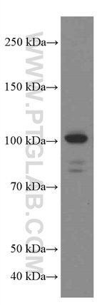 USP5 Antibody in Western Blot (WB)