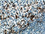 PD-1/CD279 Antibody in Immunohistochemistry (Paraffin) (IHC (P))