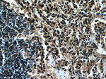 PD-1/CD279 Antibody in Immunohistochemistry (Paraffin) (IHC (P))