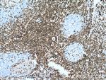 CD43 Antibody in Immunohistochemistry (Paraffin) (IHC (P))