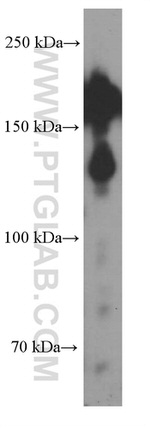 SALL4 Antibody in Western Blot (WB)