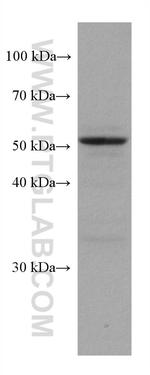 CA9 Antibody in Western Blot (WB)