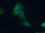 FAK Antibody in Immunocytochemistry (ICC/IF)