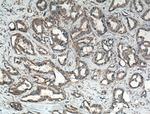 FAK Antibody in Immunohistochemistry (Paraffin) (IHC (P))