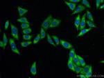 PAI-1 Antibody in Immunocytochemistry (ICC/IF)