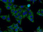 PAI-1 Antibody in Immunocytochemistry (ICC/IF)