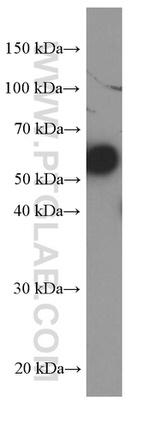 PAI-1 Antibody in Western Blot (WB)