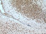 SRPX2 Antibody in Immunohistochemistry (Paraffin) (IHC (P))