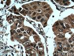 BRCA1 Antibody in Immunohistochemistry (Paraffin) (IHC (P))