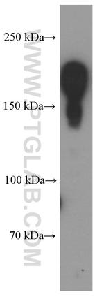 BRCA1 Antibody in Western Blot (WB)