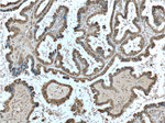 BRCA1 Antibody in Immunohistochemistry (Paraffin) (IHC (P))