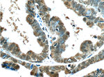 BRCA1 Antibody in Immunohistochemistry (Paraffin) (IHC (P))