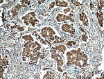 BRCA1 Antibody in Immunohistochemistry (Paraffin) (IHC (P))