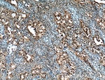 BRCA1 Antibody in Immunohistochemistry (Paraffin) (IHC (P))