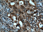 BRCA1 Antibody in Immunohistochemistry (Paraffin) (IHC (P))