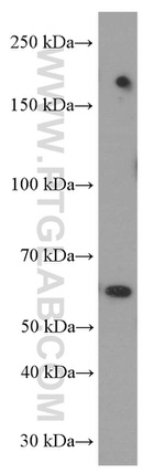 FOXN1 Antibody in Western Blot (WB)