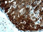 PADI2 Antibody in Immunohistochemistry (Paraffin) (IHC (P))