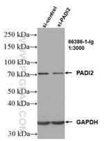 PADI2 Antibody in Western Blot (WB)