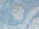 Cyclin A2 Antibody in Immunohistochemistry (Paraffin) (IHC (P))