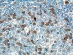 Cyclin A2 Antibody in Immunohistochemistry (Paraffin) (IHC (P))