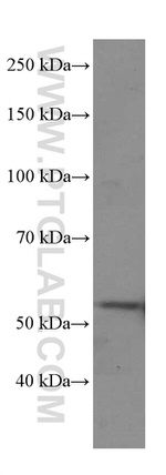 Cyclin A2 Antibody in Western Blot (WB)