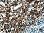 CD36 Antibody in Immunohistochemistry (Paraffin) (IHC (P))