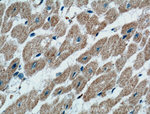 CD36 Antibody in Immunohistochemistry (Paraffin) (IHC (P))