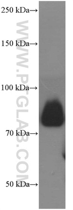 CD36 Antibody in Western Blot (WB)