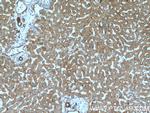 LDLR Antibody in Immunohistochemistry (Paraffin) (IHC (P))