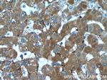 LDLR Antibody in Immunohistochemistry (Paraffin) (IHC (P))