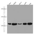 LDLR Antibody in Western Blot (WB)