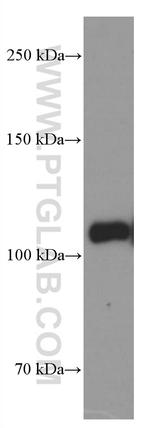 LDLR Antibody in Western Blot (WB)