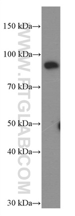 STAT5B Antibody in Western Blot (WB)