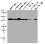 FOXO3A Antibody in Western Blot (WB)