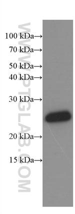 KChIP1 Antibody in Western Blot (WB)