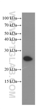 KChIP1 Antibody in Western Blot (WB)