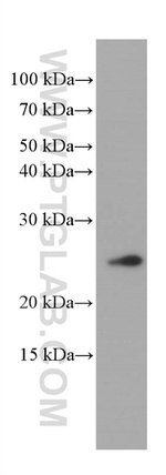 KChIP1 Antibody in Western Blot (WB)