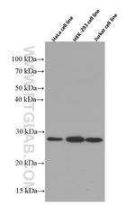 RhoGDI Antibody in Western Blot (WB)