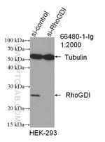 RhoGDI Antibody in Western Blot (WB)