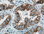 Cytokeratin 7 Antibody in Immunohistochemistry (Paraffin) (IHC (P))