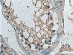 G3BP1 Antibody in Immunohistochemistry (Paraffin) (IHC (P))