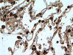 S100A4 Antibody in Immunohistochemistry (Paraffin) (IHC (P))