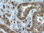 S100A4 Antibody in Immunohistochemistry (Paraffin) (IHC (P))