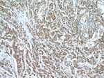 S100A4 Antibody in Immunohistochemistry (Paraffin) (IHC (P))