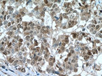 S100A4 Antibody in Immunohistochemistry (Paraffin) (IHC (P))