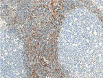 S100A4 Antibody in Immunohistochemistry (Paraffin) (IHC (P))