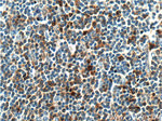 S100A4 Antibody in Immunohistochemistry (Paraffin) (IHC (P))