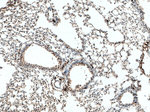 S100A4 Antibody in Immunohistochemistry (Paraffin) (IHC (P))