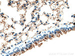 S100A4 Antibody in Immunohistochemistry (Paraffin) (IHC (P))