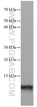 S100A4 Antibody in Western Blot (WB)